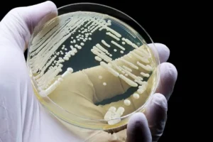 Hongo Candidozyma auris resistente: alerta sanitaria 15 Candidozyma