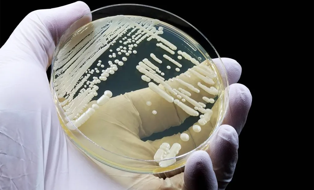 Hongo Candidozyma auris resistente: alerta sanitaria 11 Candidozyma